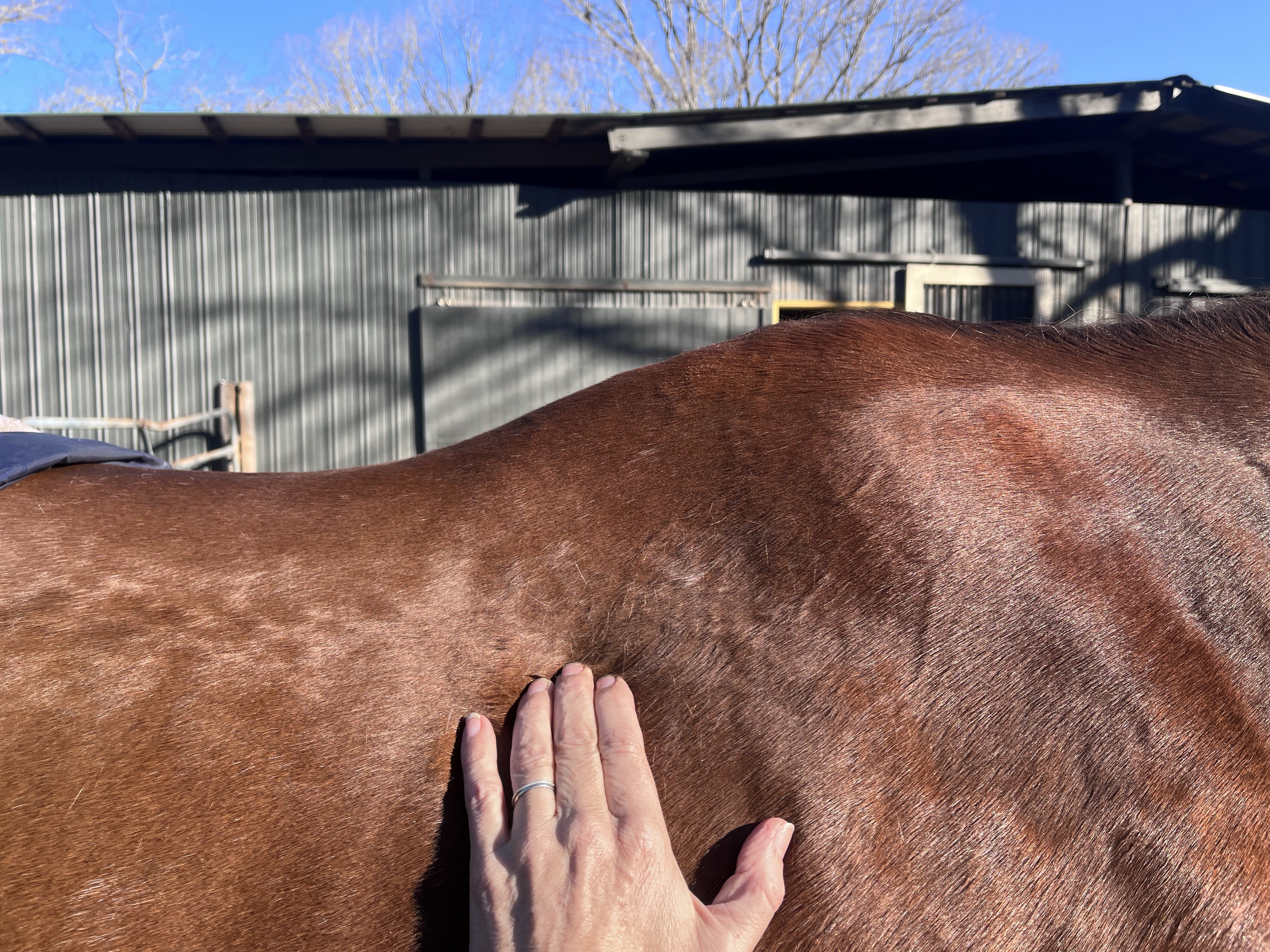 Why Fascia Softens With Manual Therapy — and How It Affects the Nervous System